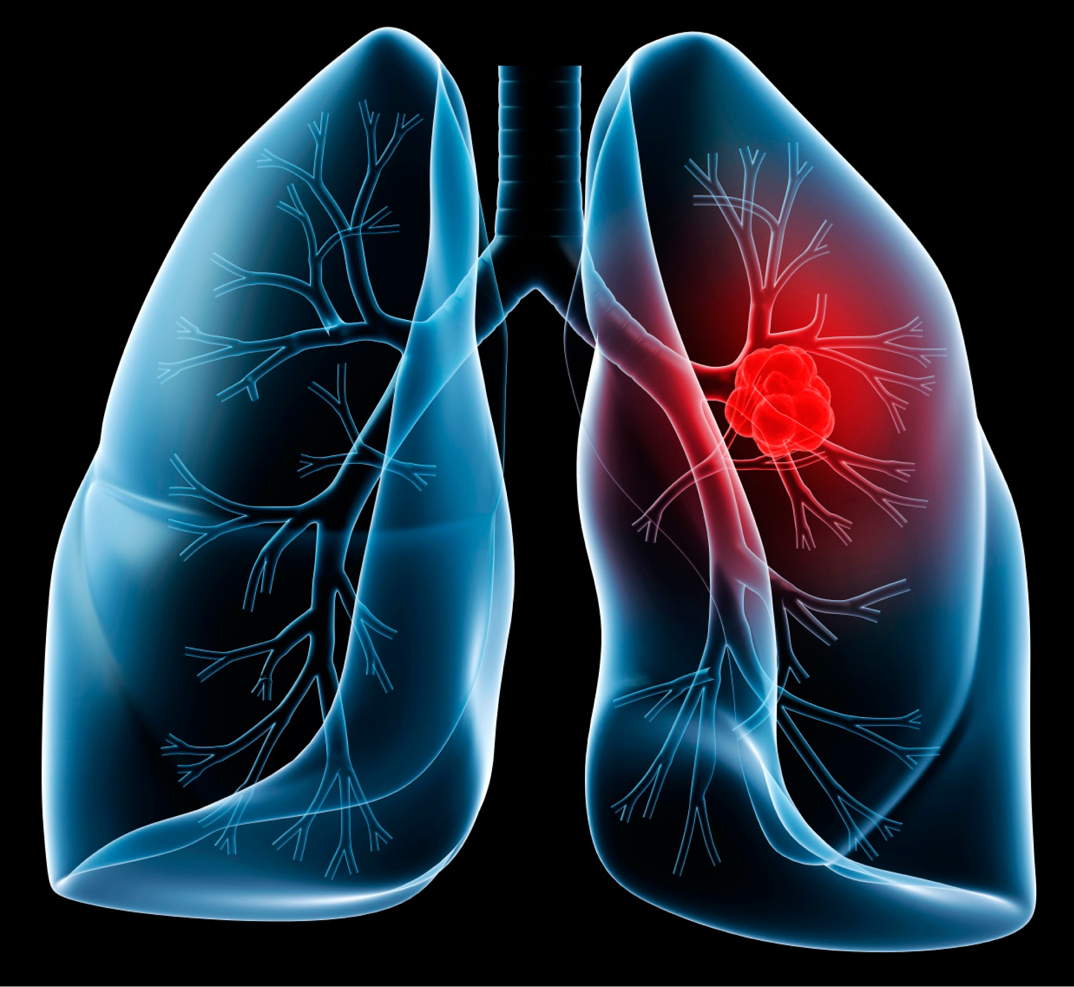 Lung Cancer Diagram For Kids Little Boy And Lungs Diagram Download